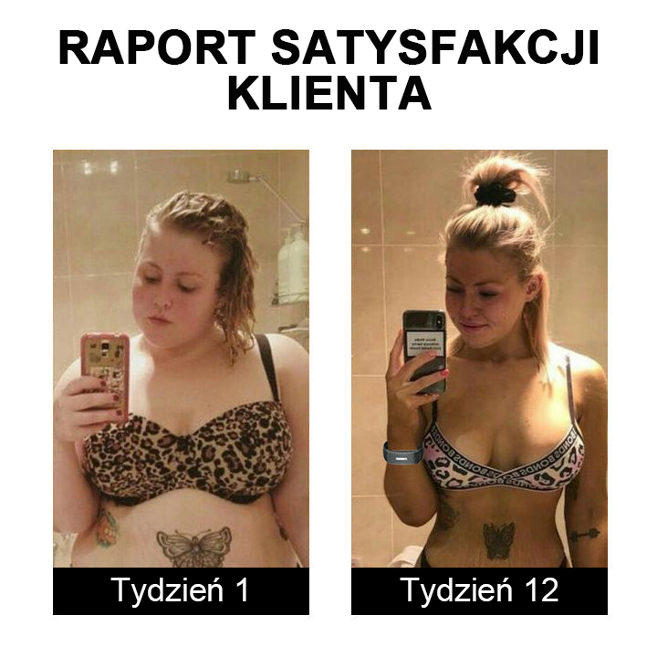 🎁 Ultrazvukové pásy pro odbourávání tuků a detoxikaci