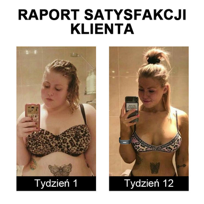 🎁 Ultrazvukové pásy pro odbourávání tuků a detoxikaci